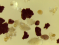 Endomykorrhizasporen zwischen feinen Partikeln einer Präparatsuspension