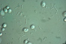 Biologischer Säureabbau abgestorbene Hefezellen
