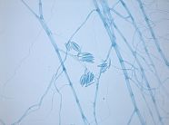 Pilzmycel von <i>Fusarium</i> sp. unter dem Mikroskop